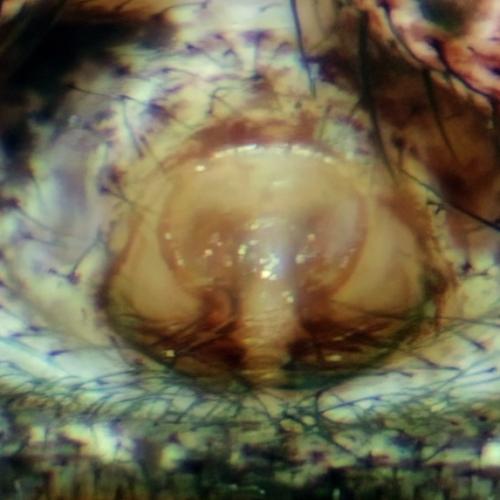 Xysticus acerbus